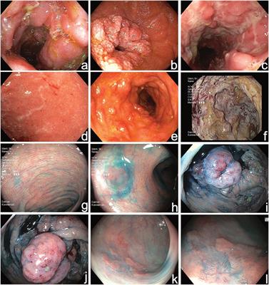 Imaging of Mucosal Inflammation: Current Technological Developments, Clinical Implications, and Future Perspectives